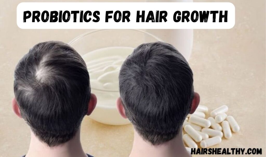 Probiotics for hair growth